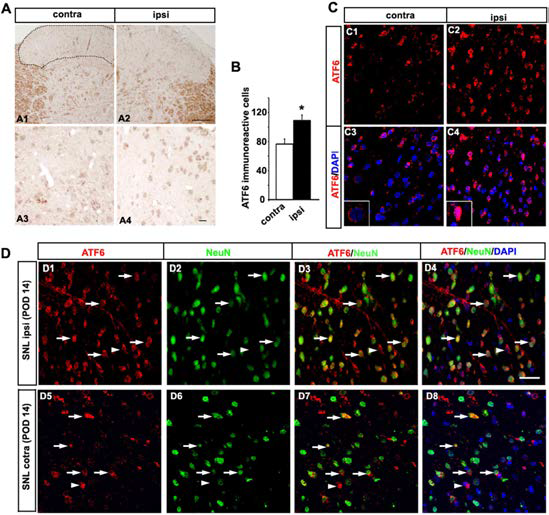 Expression of ATF6 in the spinal dorsal horn following on postsurgery day 14.