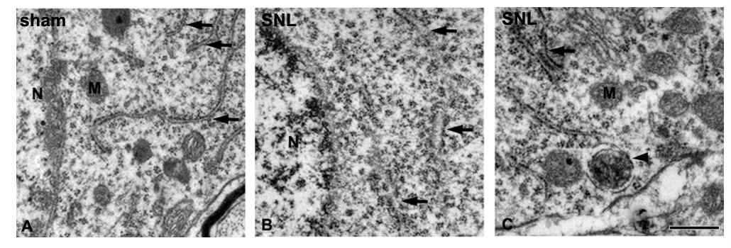 Electron microscopy of ER and autophagosome in the SNL spinal dorsal horn.