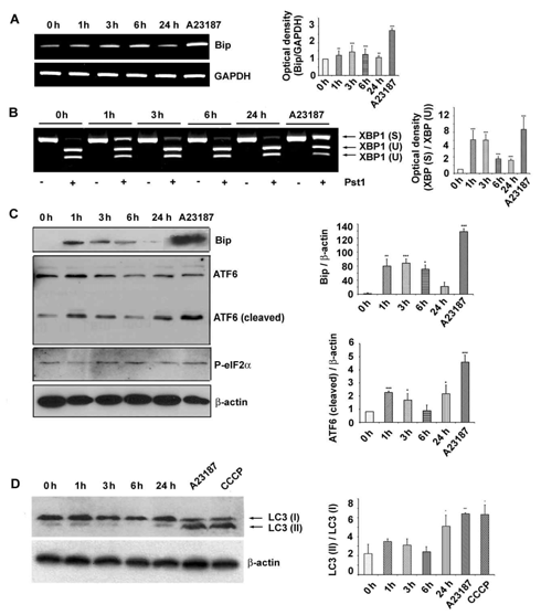 ER stress-related genes and protein were measured on times 0 (baseline), 1, 3, 6, and 24 after exchanged with condition media