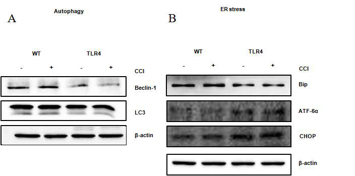 Expression of autophagy marker (A) and ER stress related protein (B) in the spinal dorsal horn following on postsurgery day 7.