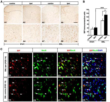 Expression of Bip in the spinal dorsal horn following on postsurgery day 14.