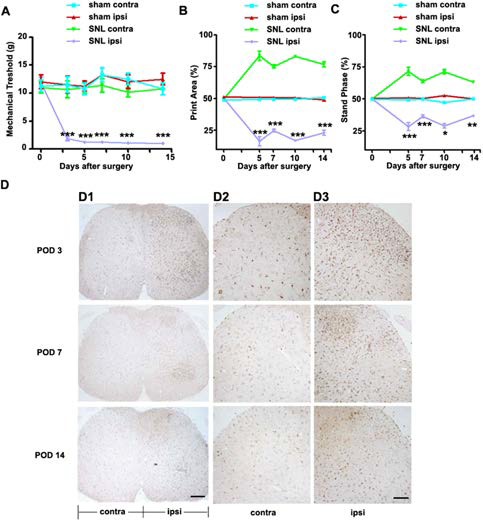 The mechanical allodynia and expression of Iba1 in the SNL.