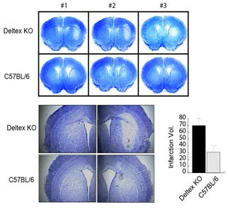 Analysis of protetection effect of Deltex against NMDA-indeced cell death