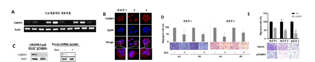 비소세포폐암 세포주에서 Cabin1이 암세포 이동에 관여