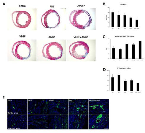 급성심근경색 동물 모델에서 VEGF-/ANG1-분비 중간엽 줄기세포의 치료 효능