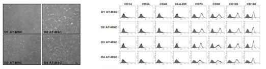 지방조직 유래 간엽줄기세포의 모양 및 세포표면항원