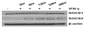 지방조직 유래 간엽줄기세포에서 IFN-γ 노출 시간에 따른 SOCS의 발현 변화