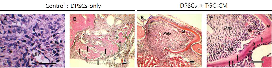 치배세포 조건 배지(TGC-CM)가 치수줄기세포의 상아모세포 분화와 상아질 형성을 유도함.