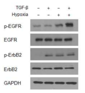 종양미세환경에 영향을 미치는 Nrf2-EGFR 상호작용 분석