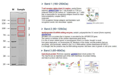 Nrf2와 결합하는 신규 단백질 동정