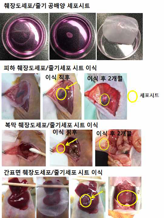 피하, 복막, 간표면 세포시 트 이식 방법 및 이식 직후, 이식 후 2개월 후의 시트 사진