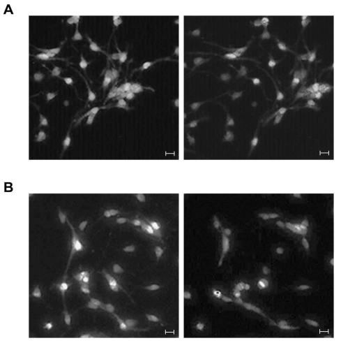 GLP151 + LPA complex는 hippocampal neural progenitor cells 형태에 영향을 미친다.