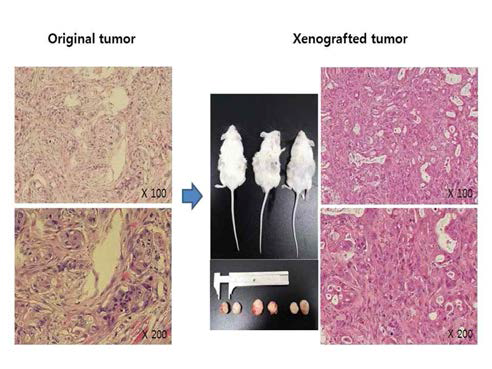 췌장암 CRC세포주의 Mouse xenograft 조직과 환자 수술 조직 병리 소견