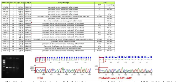 KRAS mutation, PCR, In vitro에서 췌장암의 key mutation인 KRAS의 mutation여부를 확인하여 CRC의 representative를 검증