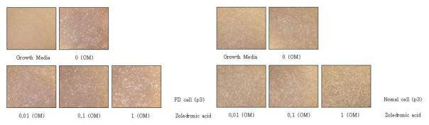 Comparisom of shape of drug treated cells using optical microscope