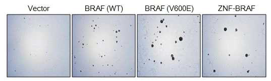 soft agar assay for tumorigenesis in vitro