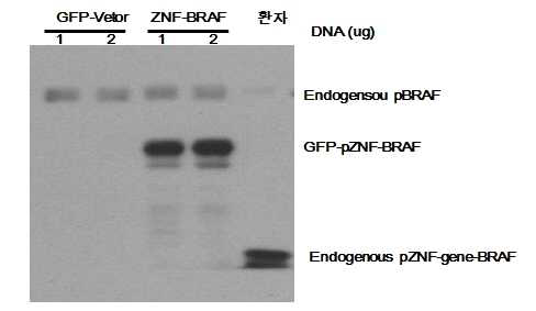 ZNF-BRAF Western Blot