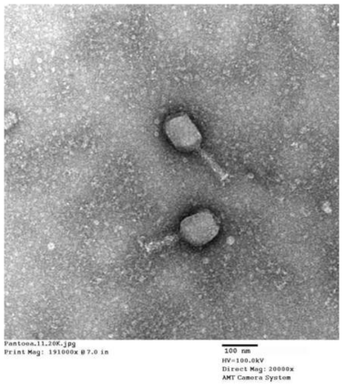 Micrograph of bacteriophage infecting E. Ludwiggi