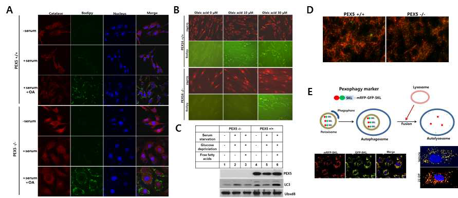 Pex5, Pex16 결여 세포주를 통한 세포소기관 상호작용 기전 구명