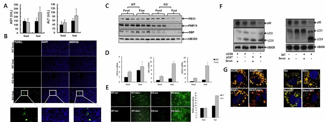 Catalase deficiency induces liver cell damage, oxidative stress, and pexophagy