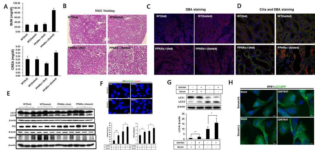 Deficiency of PPARα induces kidney damage and reduces cilia formation