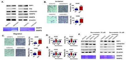 RIP1이 매개하는 세포이동성 증가 및 kinase effect의 기능