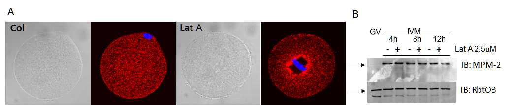 actin filament에 의한 IP3R1 재분포 및 인산화정도