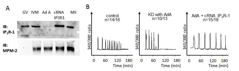 IP3R1 knockdown/ overexpression에 의한 난자 세포질 내 IP3R1 발현 및 PLCZ 에 의한 Ca2+-oscillation
