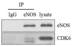 EC에서 eNOS와 CDK6의 결합 여부 분석