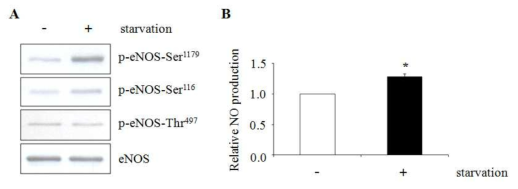 eNOS의 활성과 NO 생성에 serum starvation의 효과