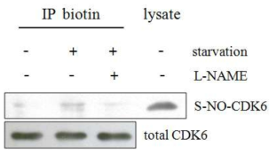 L-NAME에 의한 CDK6의 S-nitrosylation의 감소