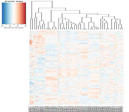 47개의 교모세포종 유래 tumor sphere의 gene expression과 unsupervised hierarchical clustering