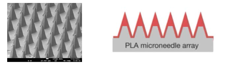 생분해성 고분자 마이크로니들위에 코팅된 diranfxmd의 SEM이미지 및 이를 도식화한 그림