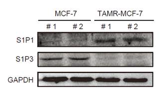 타목시펜저항성 유방암 세포모델에서 S1P1 발현 증가