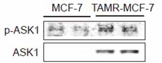타목시펜 저항성 유방암 세포모델에서 ASK1 신호 활성 증가