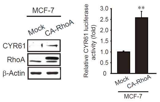 MCF-7세포에서 RhoA 과다발현에 의한 CYR61의 전사적 발현 증가