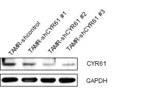 TAMR-MCF-7세포에서 shCYR61 발현 plasmid를 stable transfection한 후 CYR61의 발현 비 교