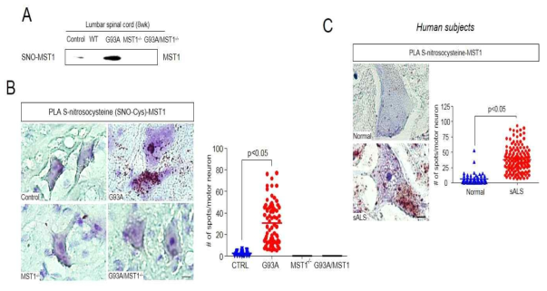 S-nitrosylation of MST1 in an animal model and human subjects of ALS