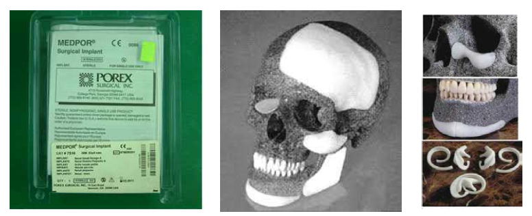 현재 사용되고 있는 Medpor제품 및 임상적용 예