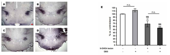 TH-immunoreactivity in the Substantia Nigra (SN).