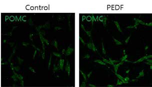 POMC4 cell line을 이용하여 PEDF Condition Media를 8시간 동안 처리 하였을 때 POMC 발현양상.