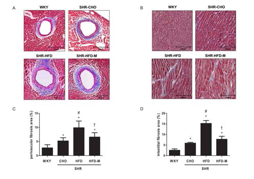 MT stain을 통한 심근 fibrosis를 각 그룹별 비교