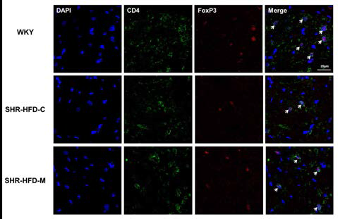 심장조 직과 림프절(mediastinal lymphnode) 에서 발현하는 Treg 의 %를 비교하고 심장조직에서 CD4+Foxp3+ 한 regulatory T cell의 발현정도를 형광염색으로 확인.