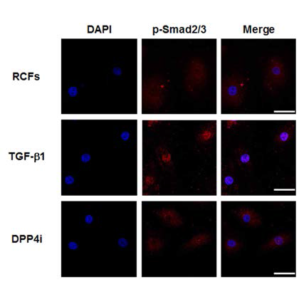 RCF cell 에서의 p-Smad2/3가 nucleus translocation이 됨을 DPP4i를 처리함으로서 억제됨을 확인