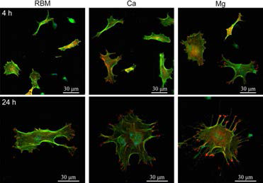 CLSM images showing cytoskeletal development and focal adhesion formation of cells on investigated surfaces.