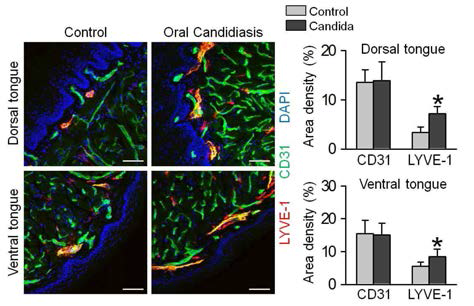 구강 및 인후의 칸디다 균증을 유발한 이후 구강 점막 하 림프절의 변화를 시각화하였을 때 점막 하 림프관의 증식을 관찰할 수 있으며 혈관의 분포는 크게 변화 없었음.