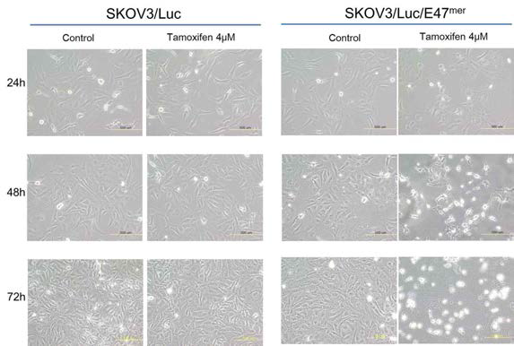대조군 난소암세포주 (SKOV-3/Luc)와 새로 확립한 실험군 난소암세포주(SKOV-3/Luc/E47mer)에서 tamoxifen을 투여한 결과 새로운 난소암 세포주에서 48시간 만에 난소암 암세포가 사멸함