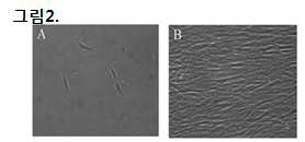 A: 초기 간엽줄기세포 형태, B: 일정기간 배양된 간엽 줄기세포 형태