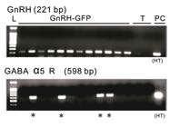 GABAA 수용체 alpha5 mRNA 발현