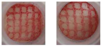 내경 5 mm/외경 6 mm 원통에 의한 연성생체조직의 변화